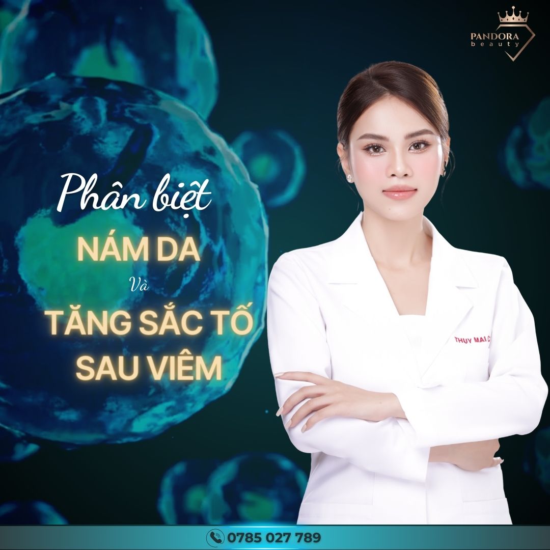 Nám da và tăng sắc tố sau viêm: Nên hiểu rõ để điều trị hiệu quả