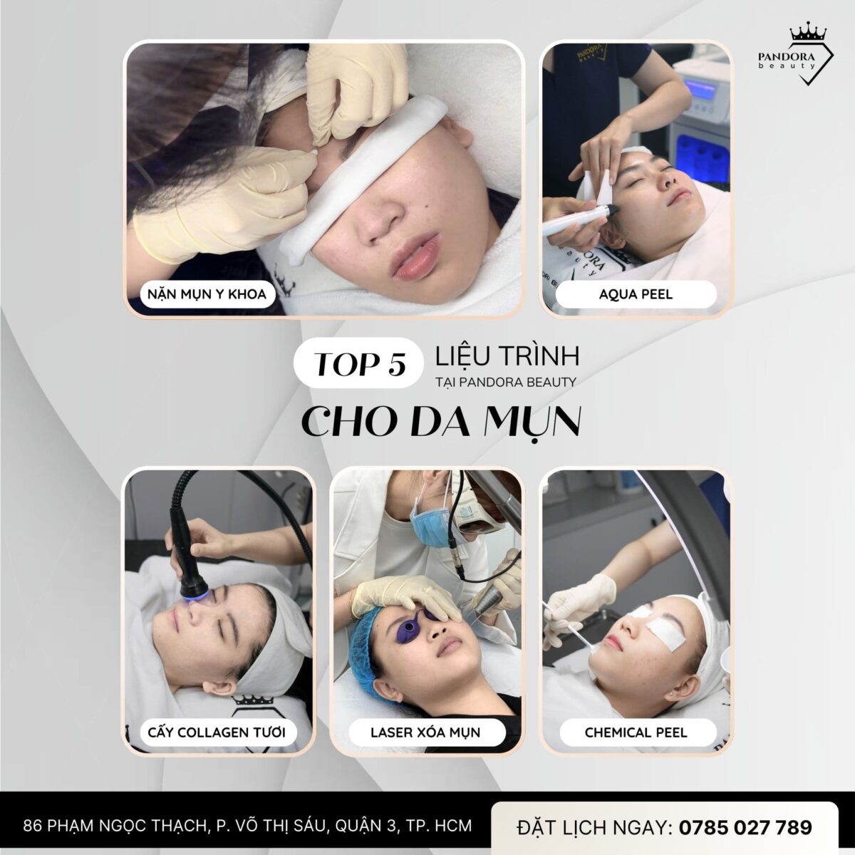 Chi phí điều trị mụn chuẩn y khoa tại Pandora Clinic