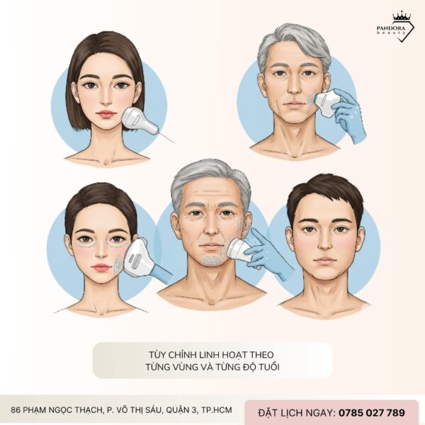 Tại sao nâng cơ HIFU MPT là xu hướng trẻ hóa năm 2025?