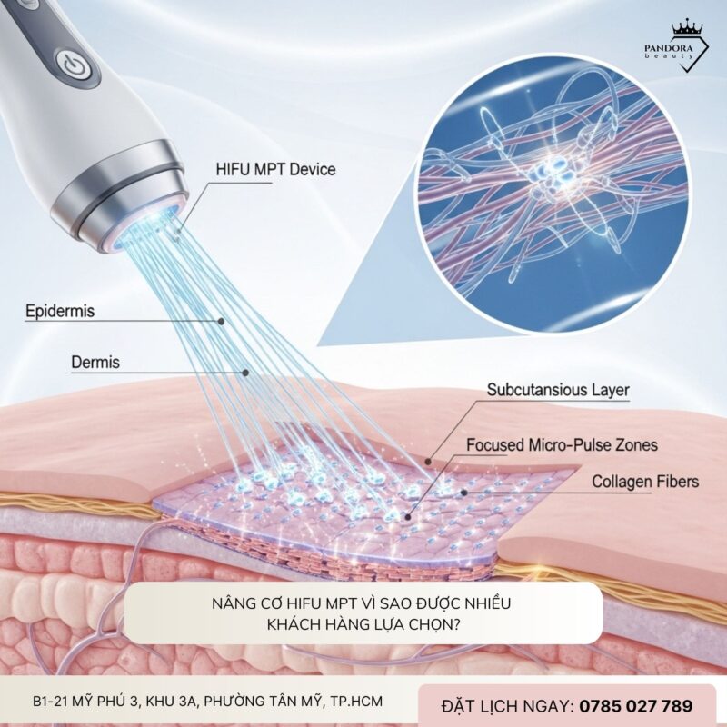 Cảm nhận của khách sau 1 tháng làm nâng cơ HIFU MPT: Bí quyết trẻ hóa an toàn, hiệu quả