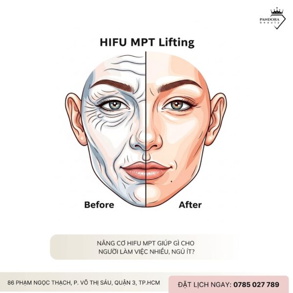 Nâng cơ HIFU MPT giúp gì cho người làm việc nhiều, ngủ ít?