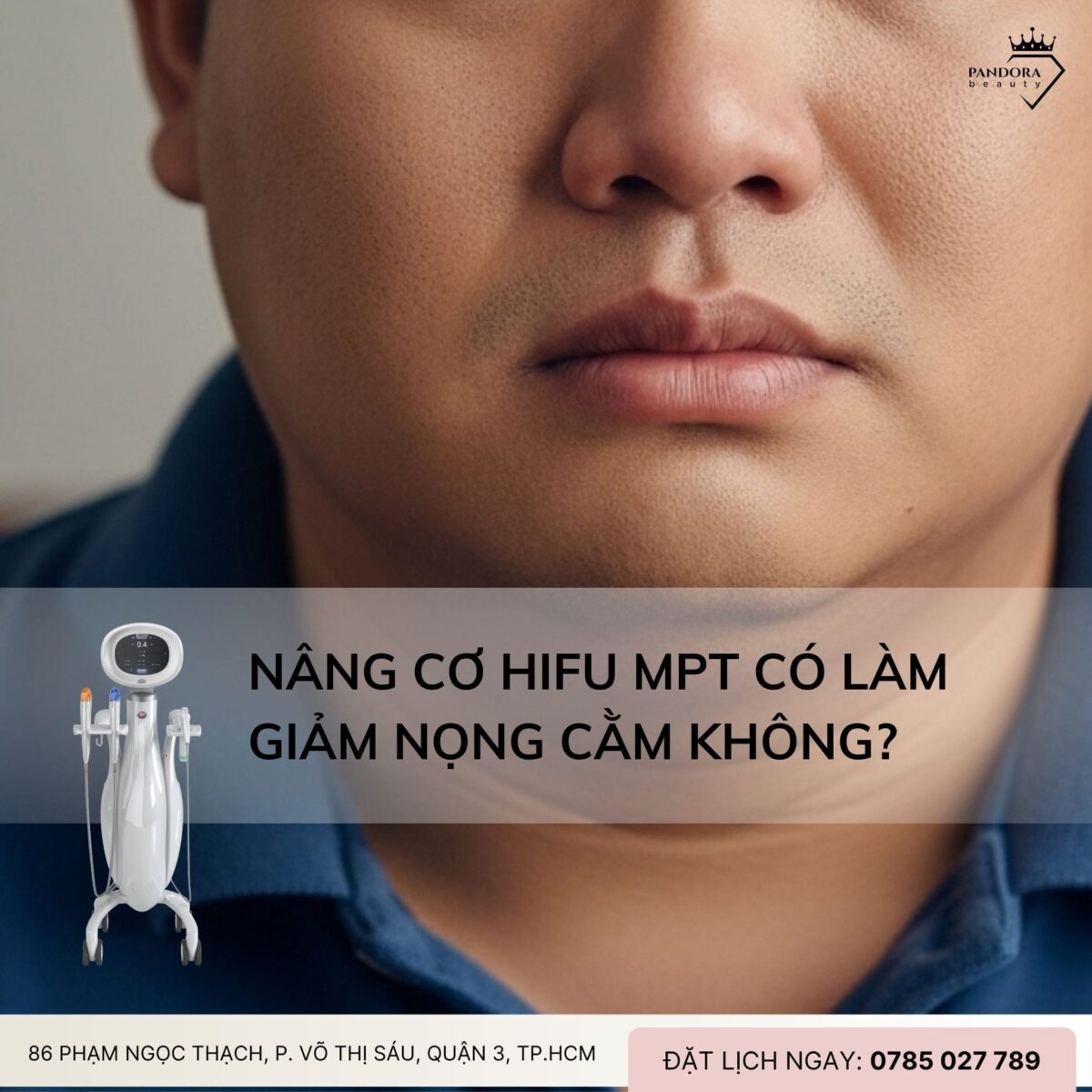 Nâng cơ HIFU MPT có làm giảm nọng cằm không? Câu trả lời khoa học & thực tế dành cho bạn