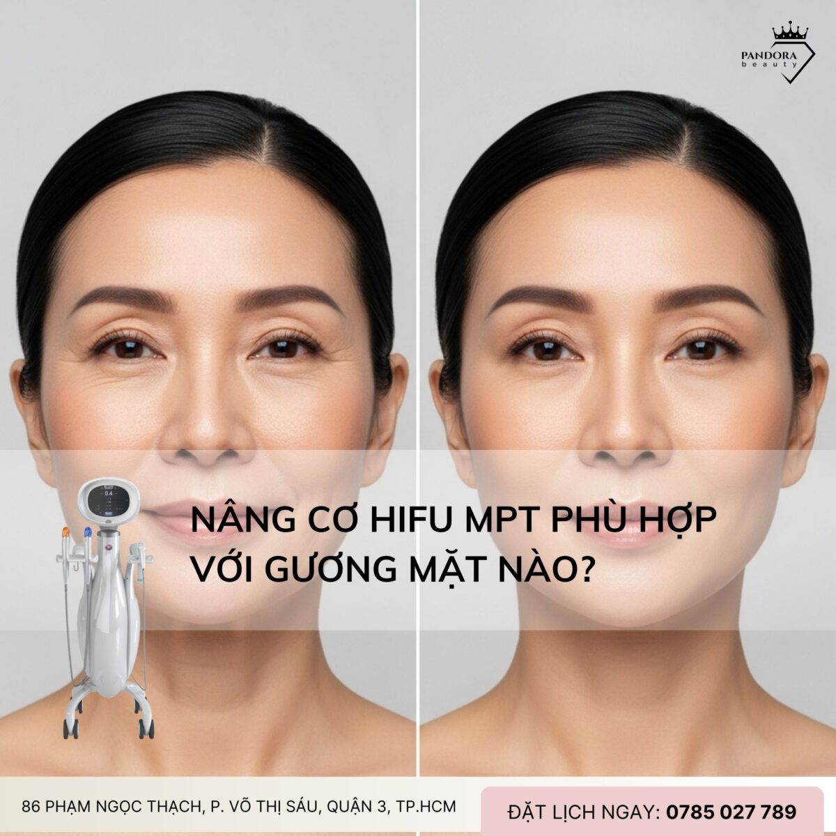 Nâng cơ HIFU MPT phù hợp với gương mặt nào?