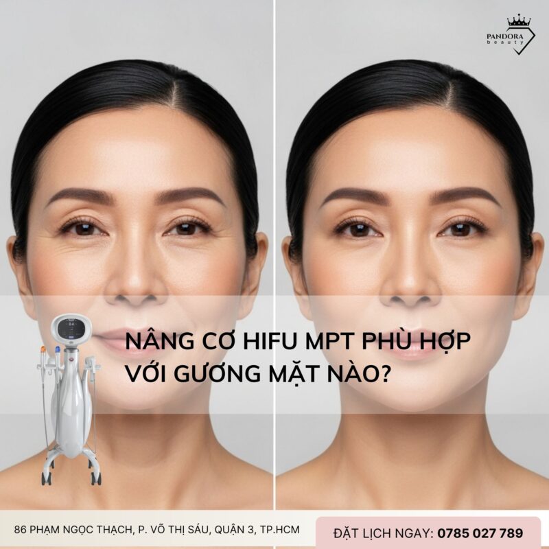 Nâng cơ HIFU MPT phù hợp với gương mặt nào?