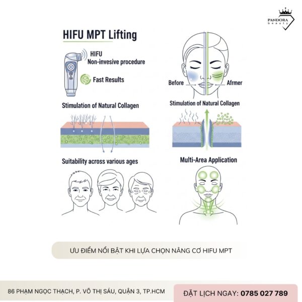 Nâng cơ HIFU MPT phù hợp với gương mặt nào?