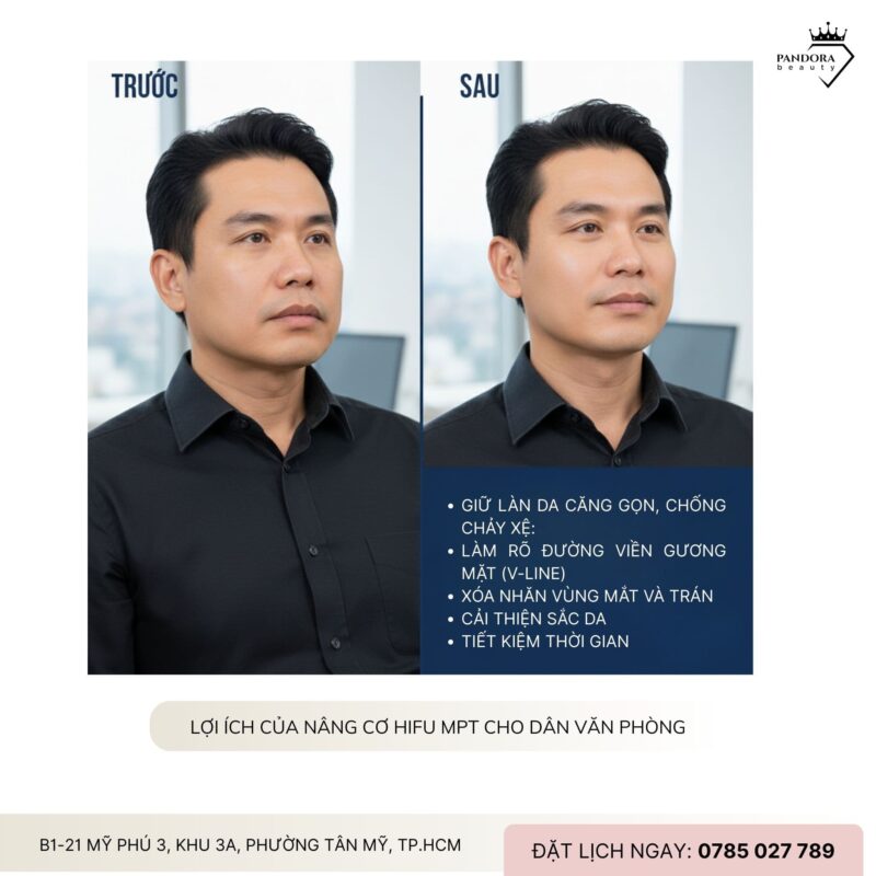 Nâng cơ HIFU MPT – Bí quyết giữ da gọn căng cho dân văn phòng làm việc 12 tiếng/ngày