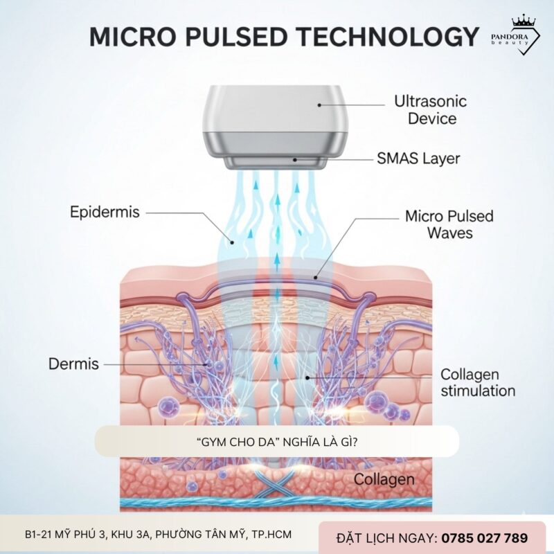 Tại sao nâng cơ HIFU MPT được gọi là “gym cho làn da” của năm 2025?