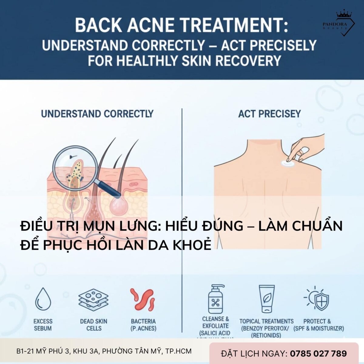 Điều trị mụn lưng: Hiểu đúng – Làm chuẩn để phục hồi làn da khoẻ