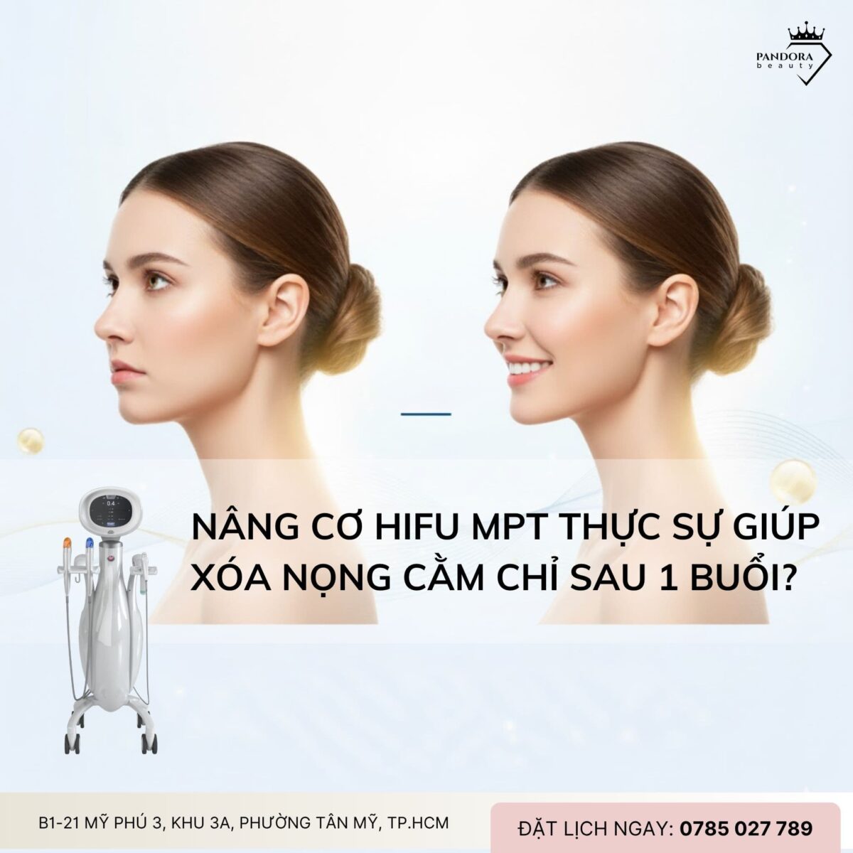 Nâng cơ HIFU MPT có thực sự giúp xóa nọng cằm chỉ sau 1 buổi?