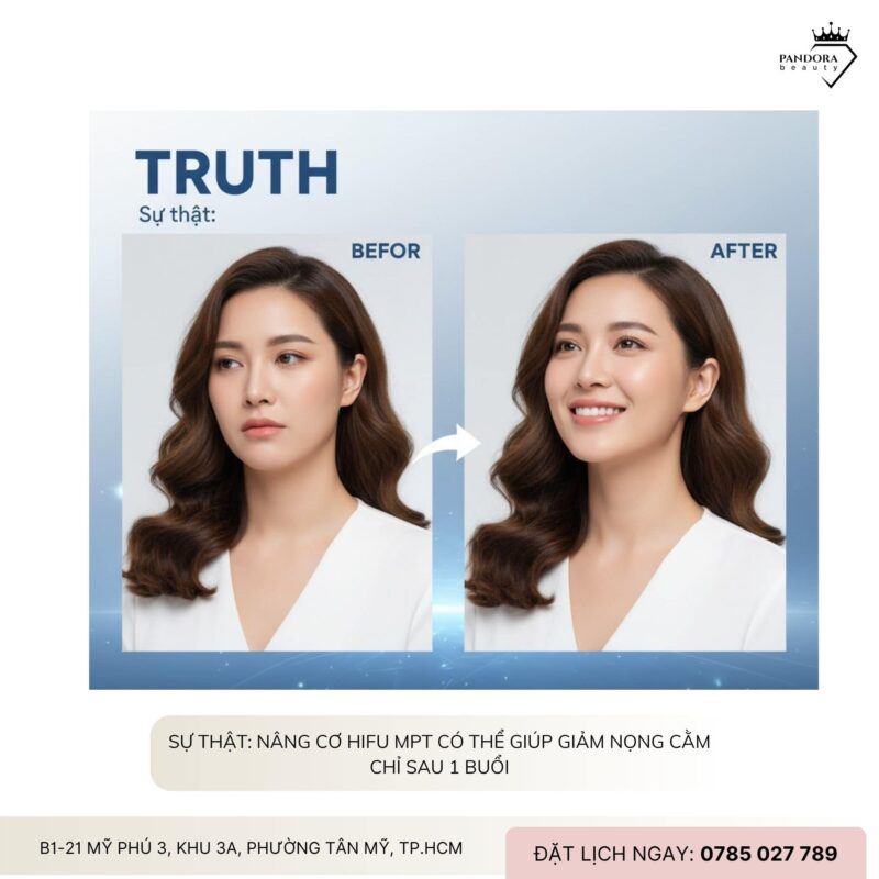 Nâng cơ HIFU MPT có thực sự giúp xóa nọng cằm chỉ sau 1 buổi?