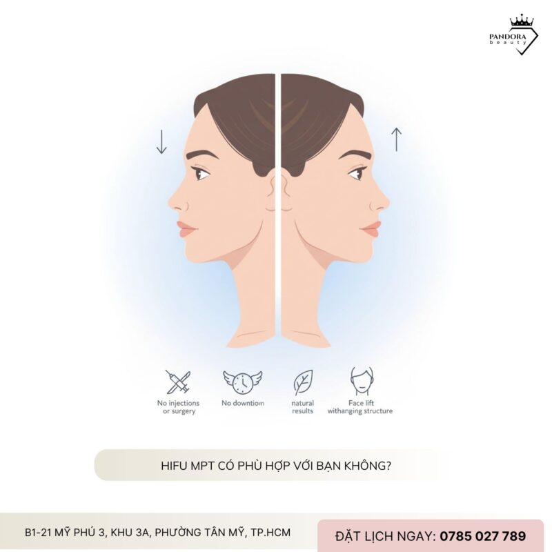 Nâng cơ HIFU MPT có thực sự giúp xóa nọng cằm chỉ sau 1 buổi?