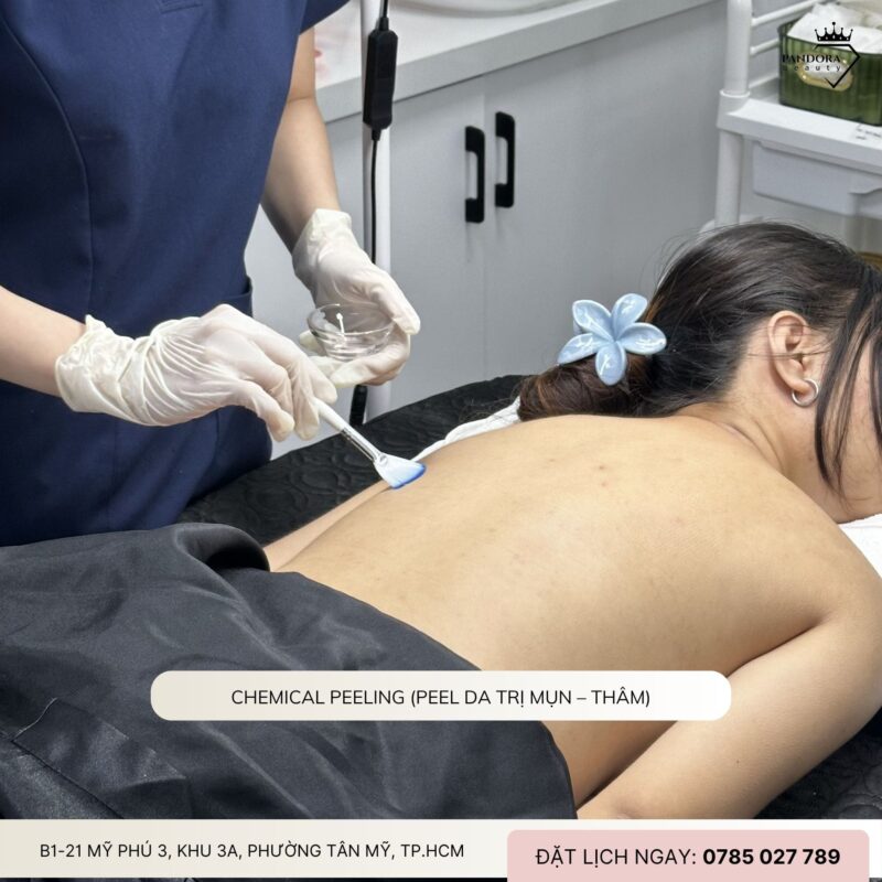 Quy trình điều trị mụn lưng tại spa/thẩm mỹ viện như Pandora Beauty: Chuẩn y khoa – Hiệu quả – An toàn