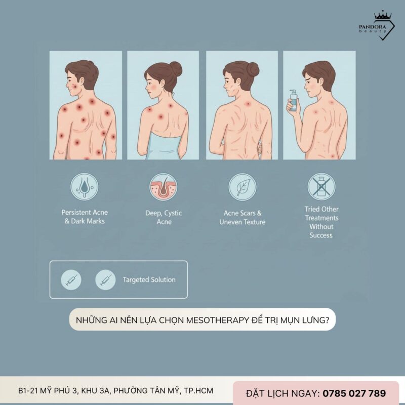 Trị mụn lưng chuyên sâu với Mesotherapy – Giải pháp phục hồi làn da từ gốc