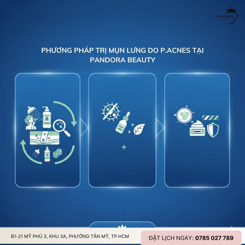 Trị mụn lưng do P.acnes – Giải pháp chuyên sâu cho làn da lưng sạch mịn