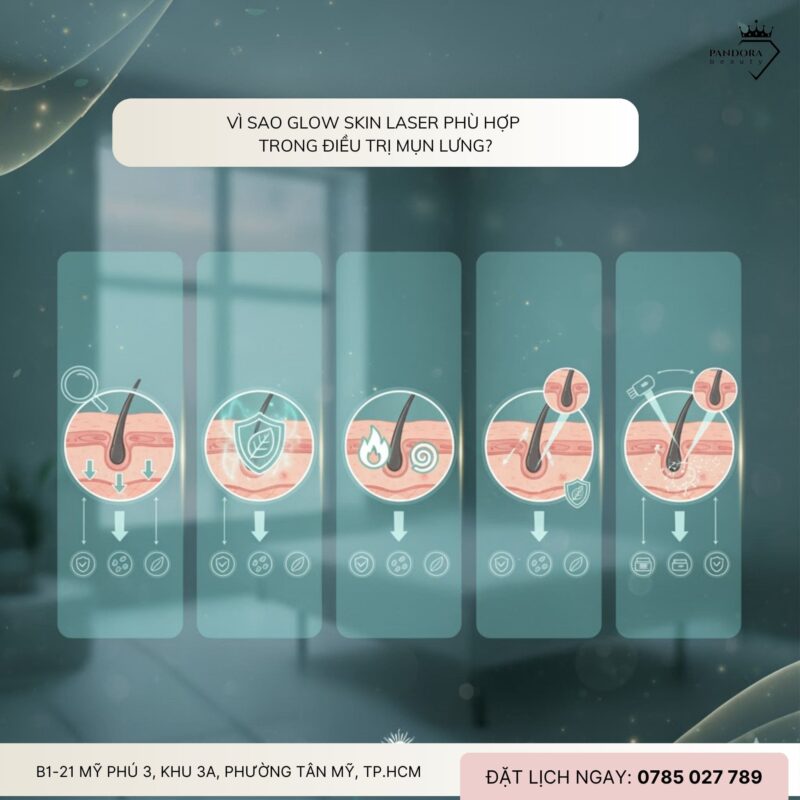 Điều trị mụn lưng với Glow Skin Laser: Giải pháp chuẩn y khoa cho làn da mịn màng