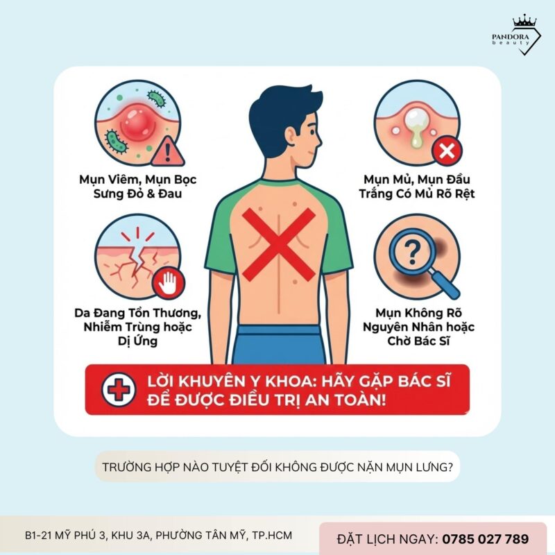 Có nên tự nặn mụn điều trị mụn lưng lưng?