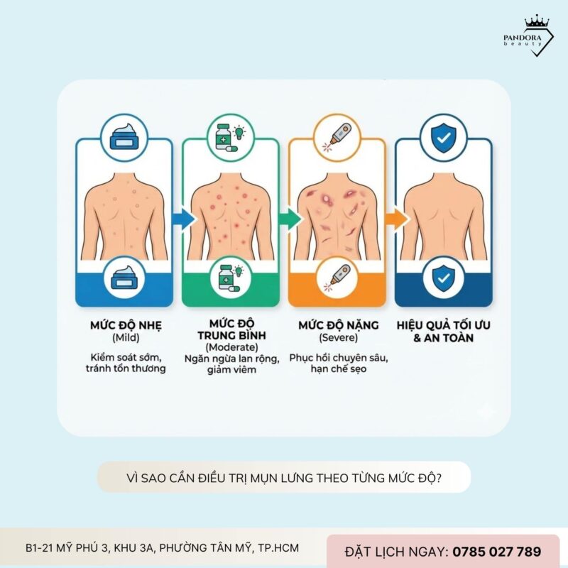 Điều trị mụn lưng theo từng mức độ: Hiểu đúng để trị mụn lưng hiệu quả và bền vững
