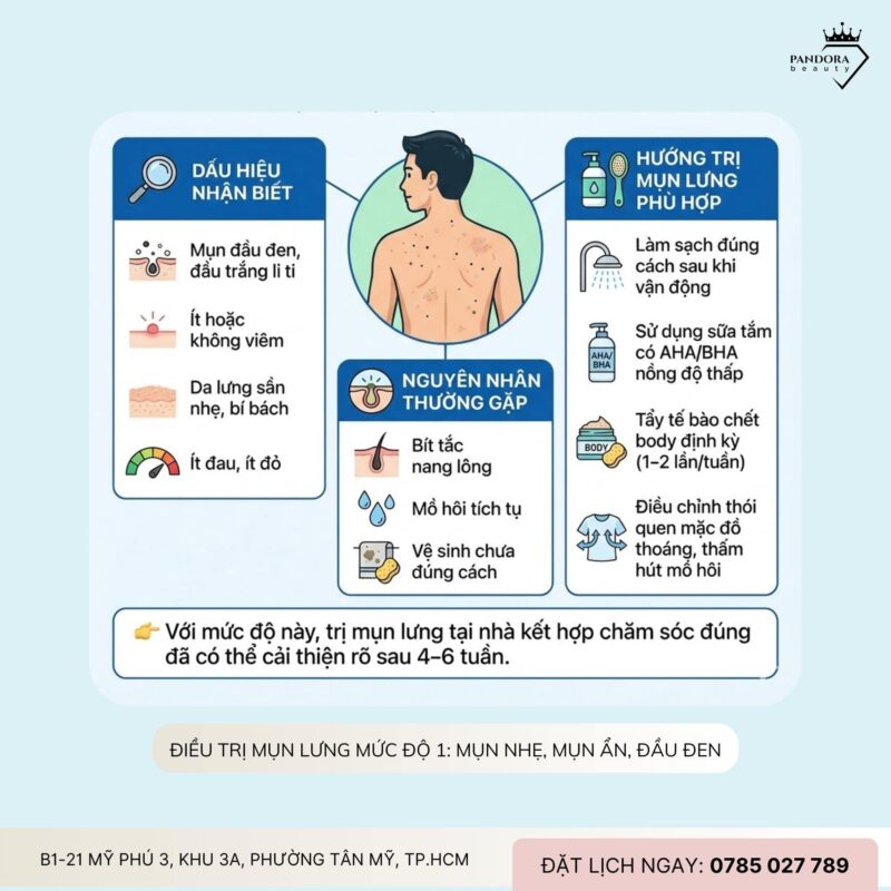 Điều trị mụn lưng theo từng mức độ: Hiểu đúng để trị mụn lưng hiệu quả và bền vững