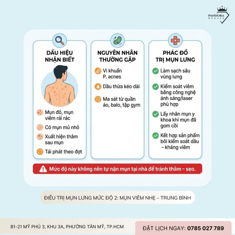 Điều trị mụn lưng theo từng mức độ: Hiểu đúng để trị mụn lưng hiệu quả và bền vững
