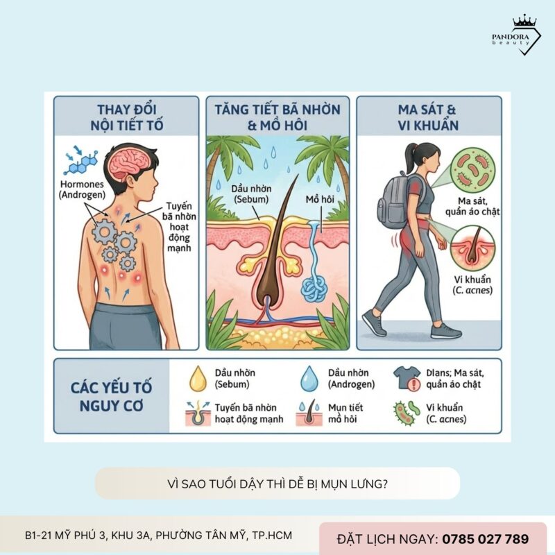 Điều trị mụn lưng tuổi dậy thì: Hiểu đúng – Chăm đúng – Khỏi đúng