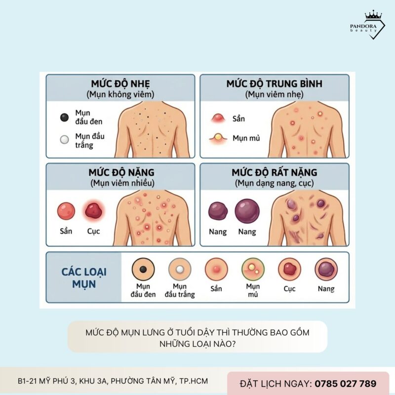 Điều trị mụn lưng tuổi dậy thì: Hiểu đúng – Chăm đúng – Khỏi đúng