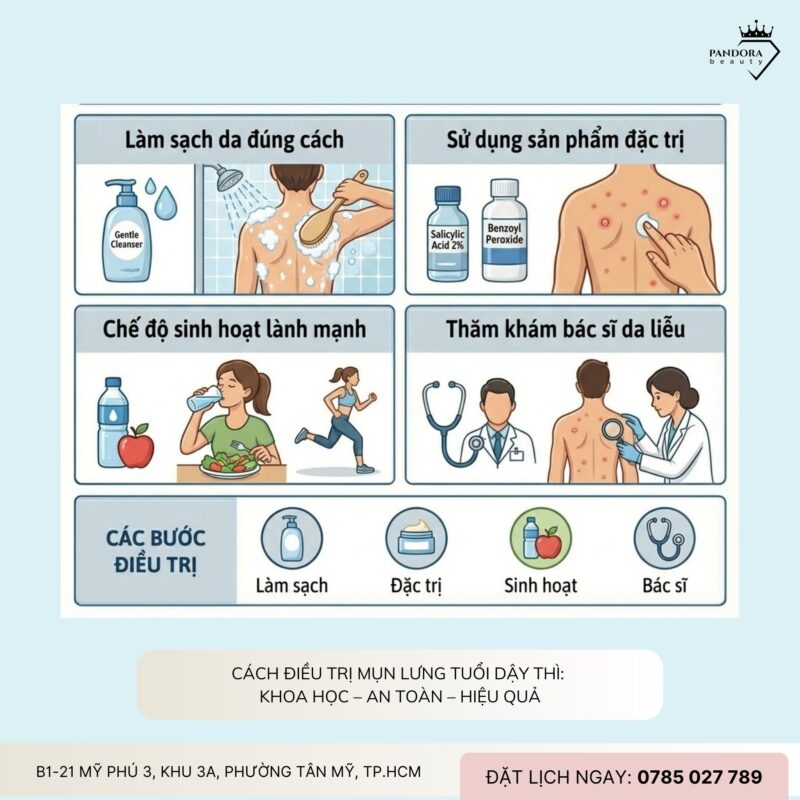 Điều trị mụn lưng tuổi dậy thì: Hiểu đúng – Chăm đúng – Khỏi đúng