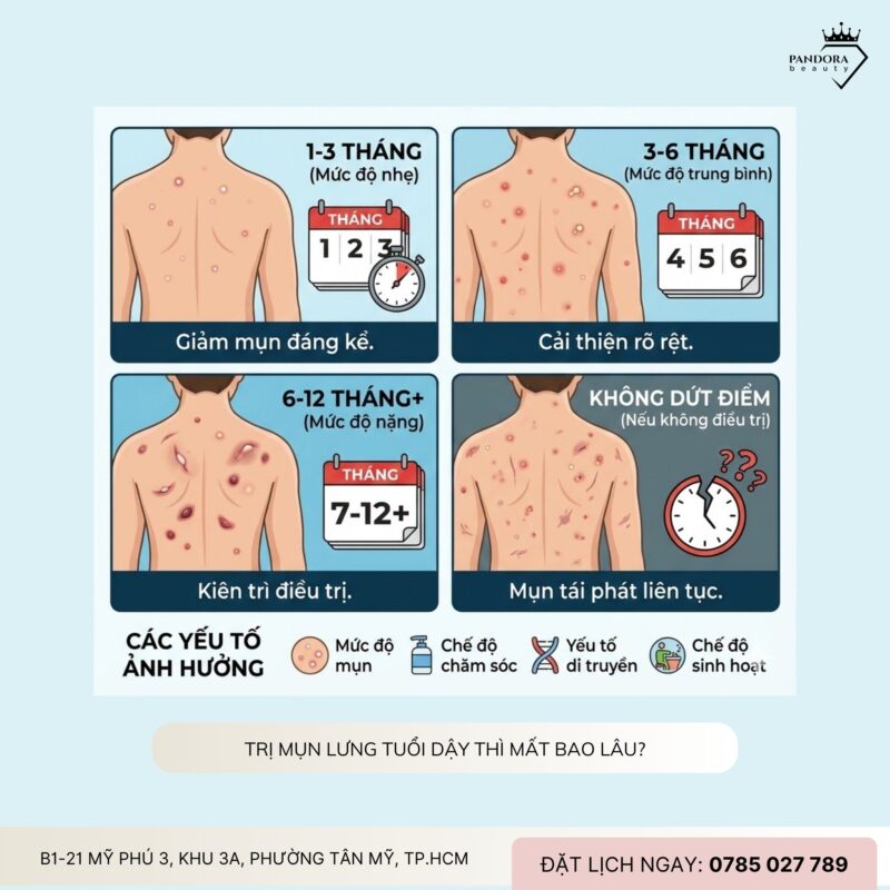 Điều trị mụn lưng tuổi dậy thì: Hiểu đúng – Chăm đúng – Khỏi đúng