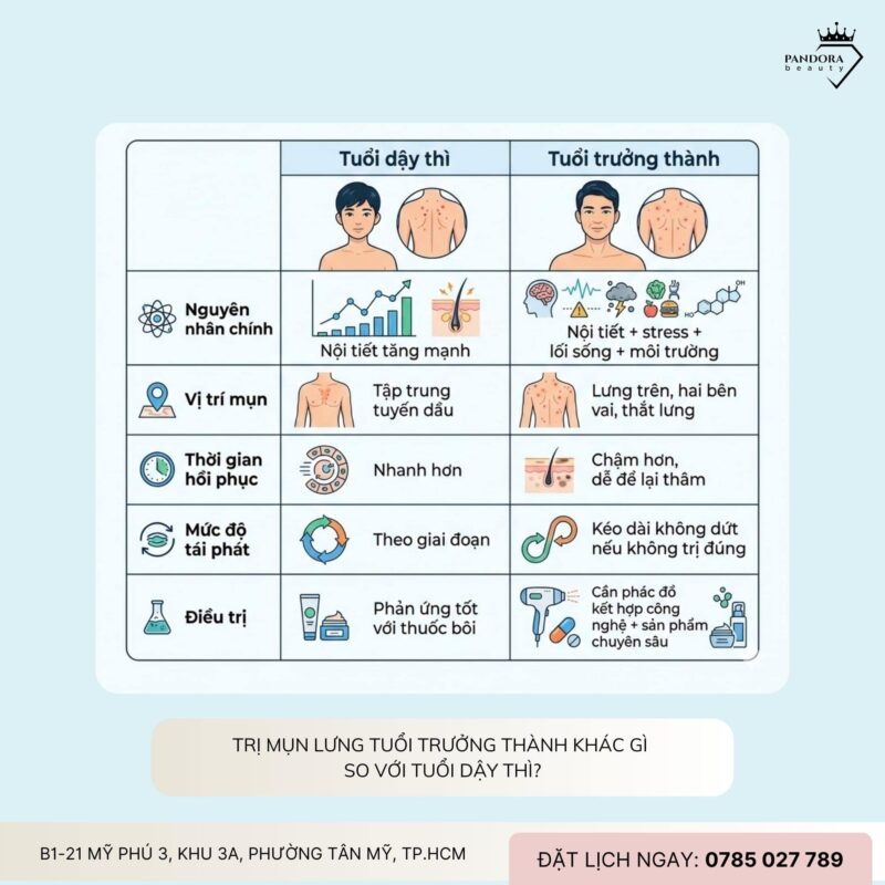 Điều trị mụn lưng tuổi trưởng thành: Hiểu đúng – trị đúng – hết tái phát