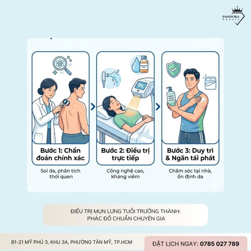 Điều trị mụn lưng tuổi trưởng thành: Hiểu đúng – trị đúng – hết tái phát