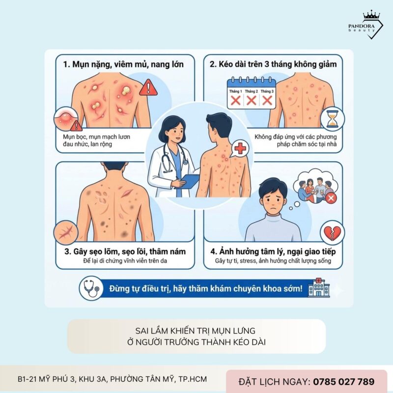 Điều trị mụn lưng tuổi trưởng thành: Hiểu đúng – trị đúng – hết tái phát