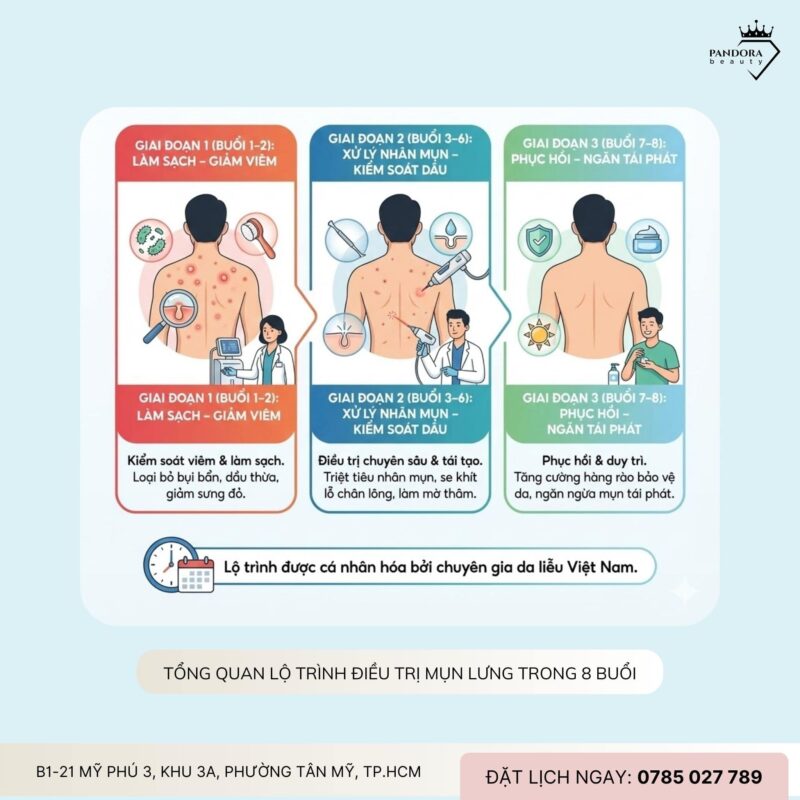 Lộ trình điều trị mụn lưng trong 8 buổi: Hiệu quả đến đâu và cần lưu ý gì?
