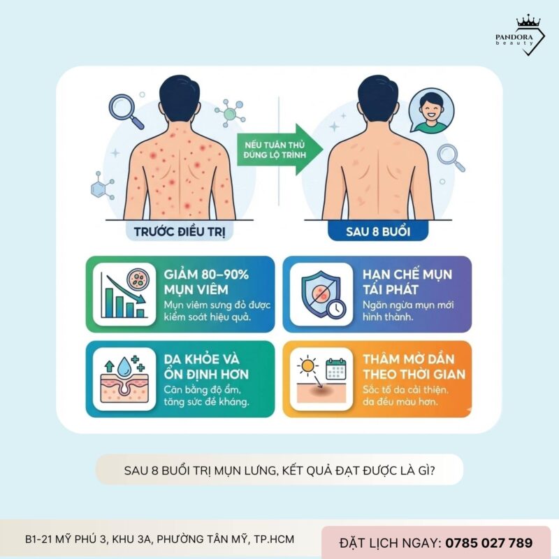 Lộ trình điều trị mụn lưng trong 8 buổi: Hiệu quả đến đâu và cần lưu ý gì?