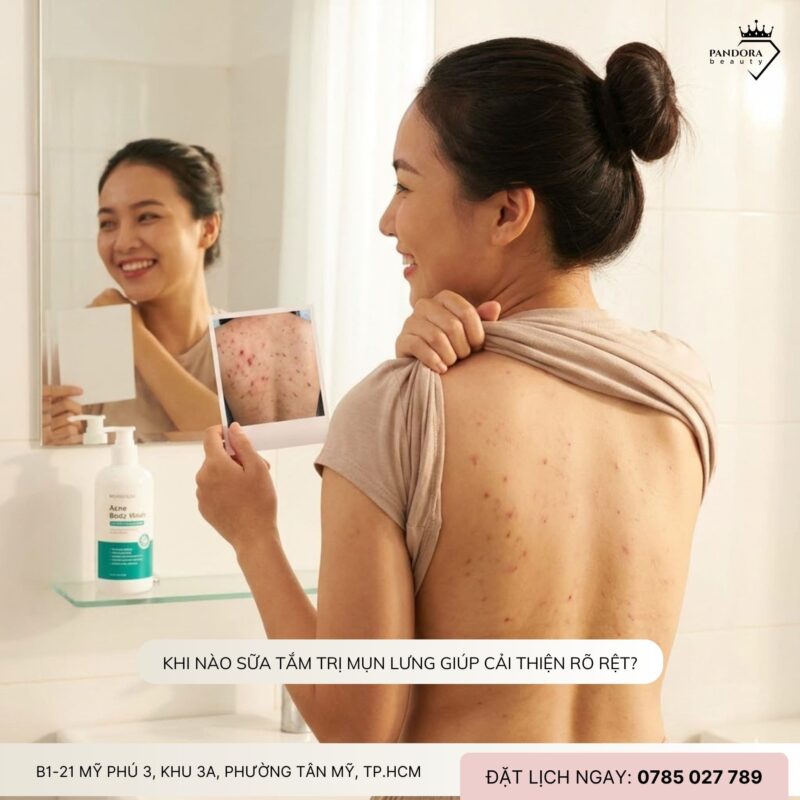 Trị mụn lưng: Sữa tắm trị mụn lưng có thật sự hiệu quả không?