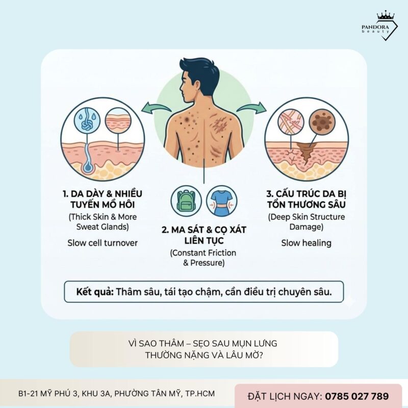 Thâm – sẹo sau điều trị mụn lưng: Làm sao cải thiện hiệu quả và an toàn?