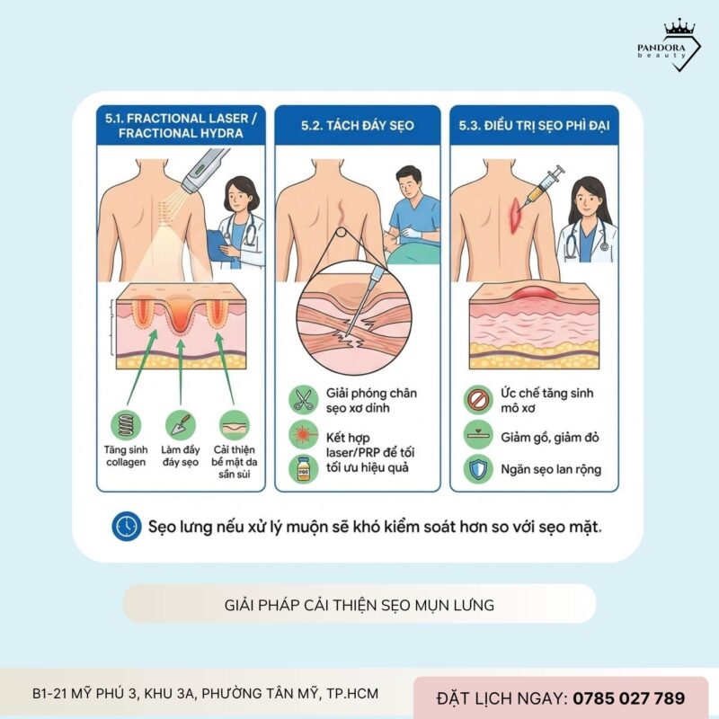 Thâm – sẹo sau điều trị mụn lưng: Làm sao cải thiện hiệu quả và an toàn?