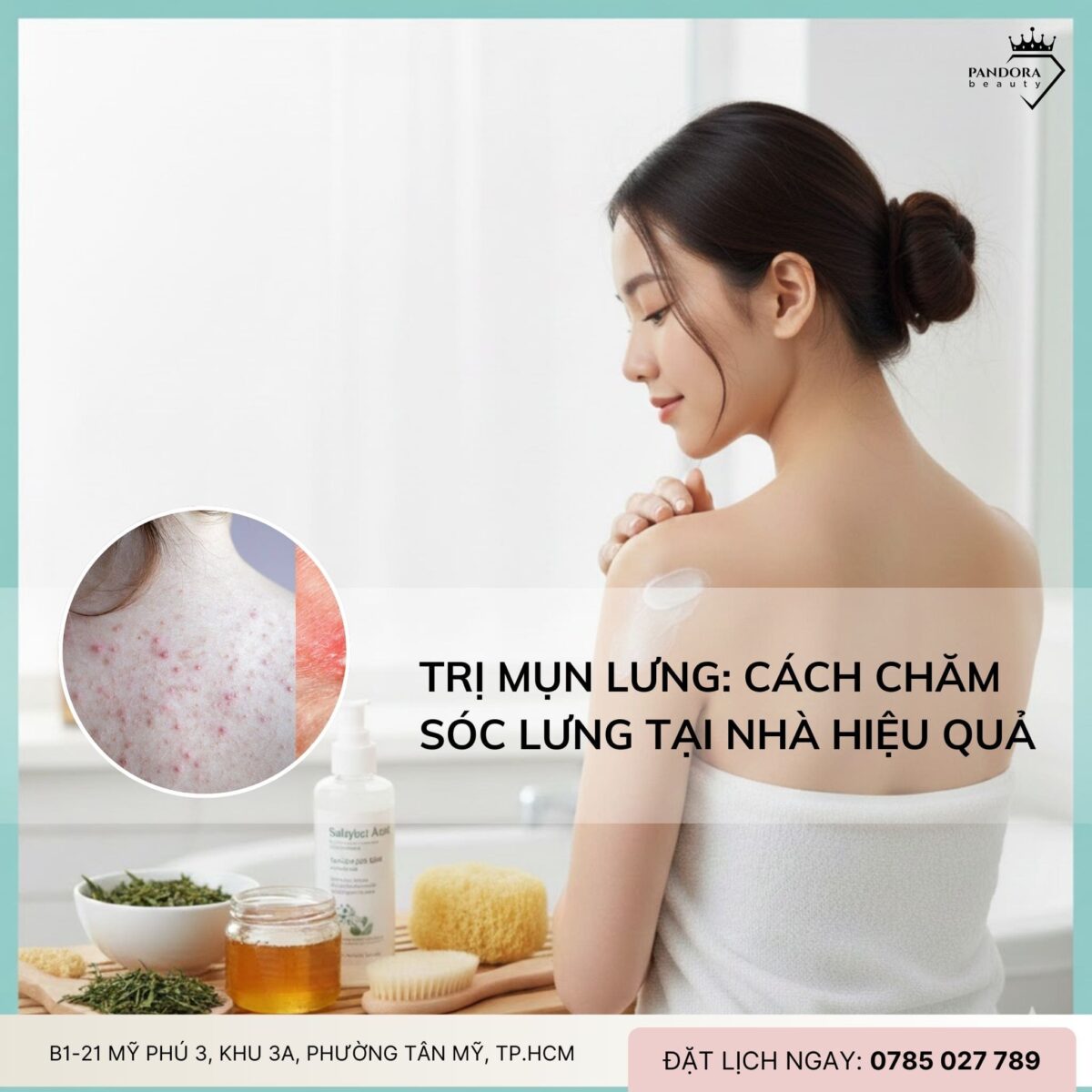 Trị mụn lưng: Cách chăm sóc lưng tại nhà hiệu quả – an toàn – hỗ trợ điều trị tối ưu