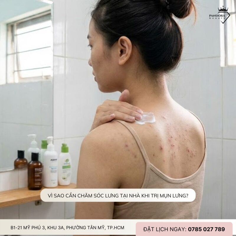 Trị mụn lưng: Cách chăm sóc lưng tại nhà hiệu quả – an toàn – hỗ trợ điều trị tối ưu