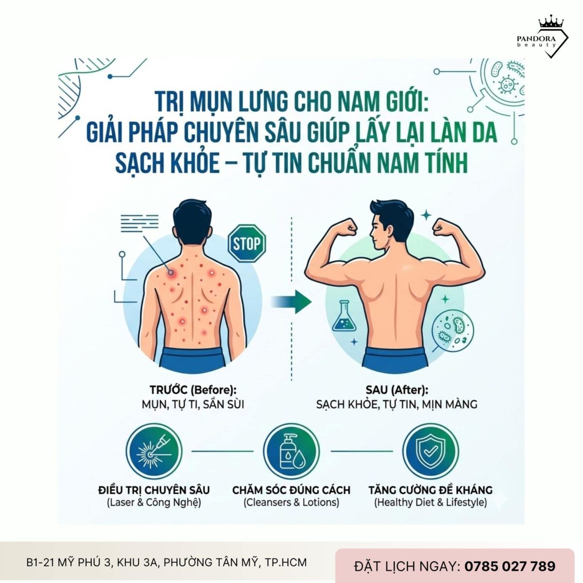 Trị mụn lưng cho nam giới: Giải pháp chuyên sâu giúp lấy lại làn da sạch khỏe – tự tin chuẩn nam tính