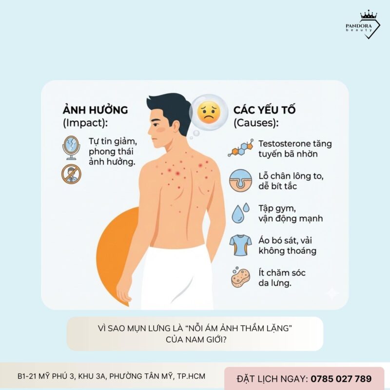 Trị mụn lưng cho nam giới: Giải pháp chuyên sâu giúp lấy lại làn da sạch khỏe – tự tin chuẩn nam tính