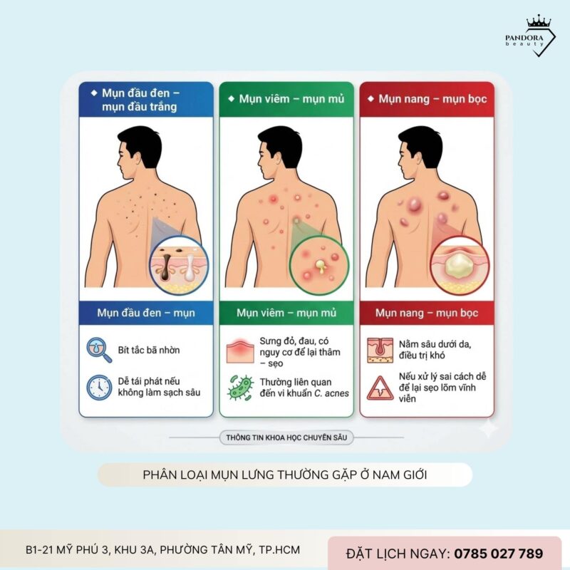 Trị mụn lưng cho nam giới: Giải pháp chuyên sâu giúp lấy lại làn da sạch khỏe – tự tin chuẩn nam tính