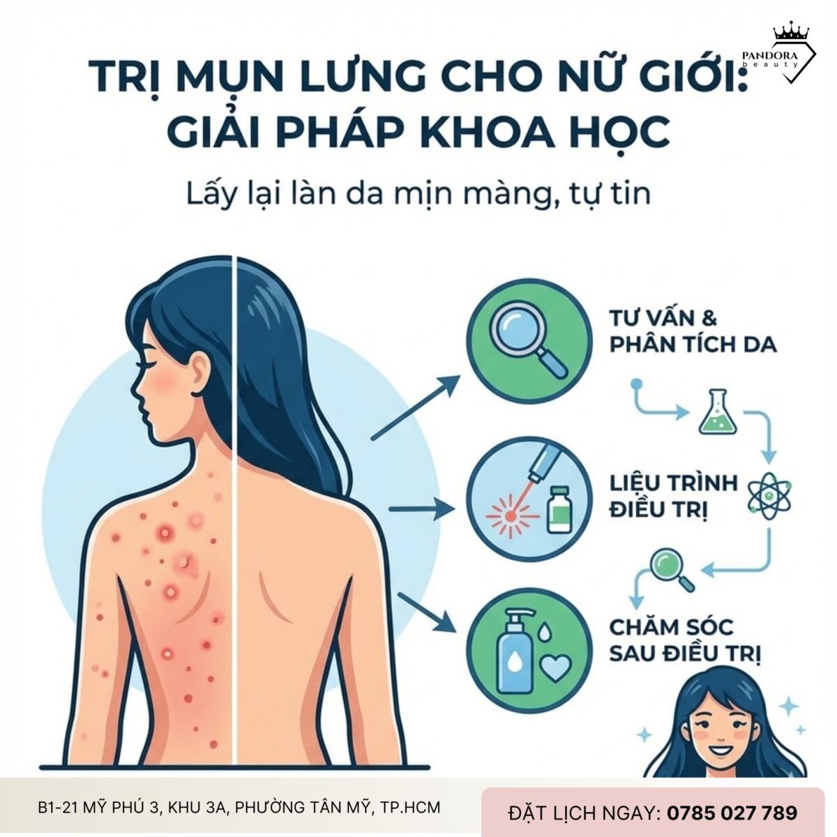 Trị mụn lưng cho nữ giới: Giải pháp khoa học để lấy lại làn da mịn màng, tự tin