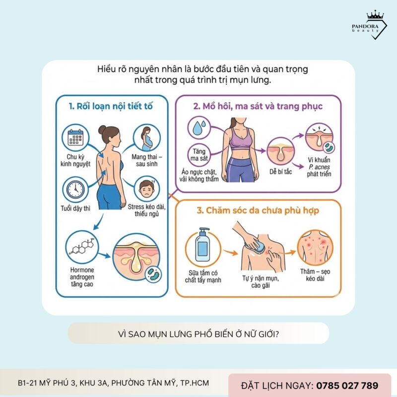 Trị mụn lưng cho nữ giới: Giải pháp khoa học để lấy lại làn da mịn màng, tự tin
