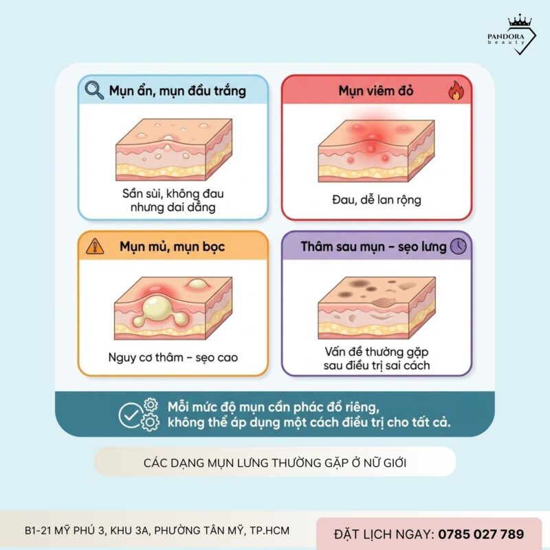 Trị mụn lưng cho nữ giới: Giải pháp khoa học để lấy lại làn da mịn màng, tự tin