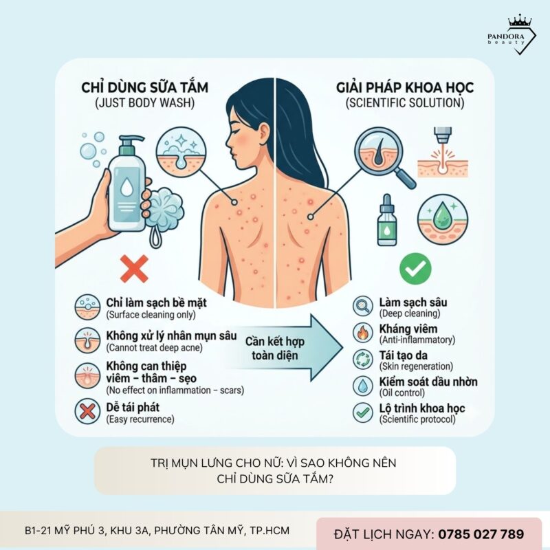 Trị mụn lưng cho nữ giới: Giải pháp khoa học để lấy lại làn da mịn màng, tự tin