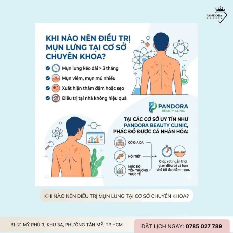 Trị mụn lưng cho nữ giới: Giải pháp khoa học để lấy lại làn da mịn màng, tự tin