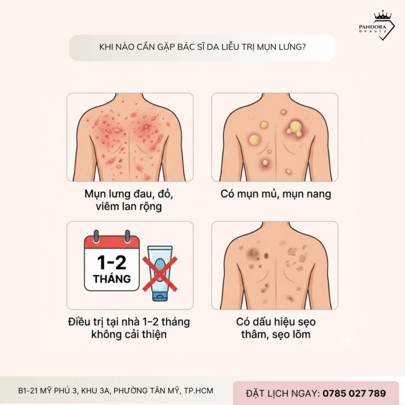 Trị mụn lưng: Thói quen gây mụn lưng & cách chữa đúng, dứt điểm