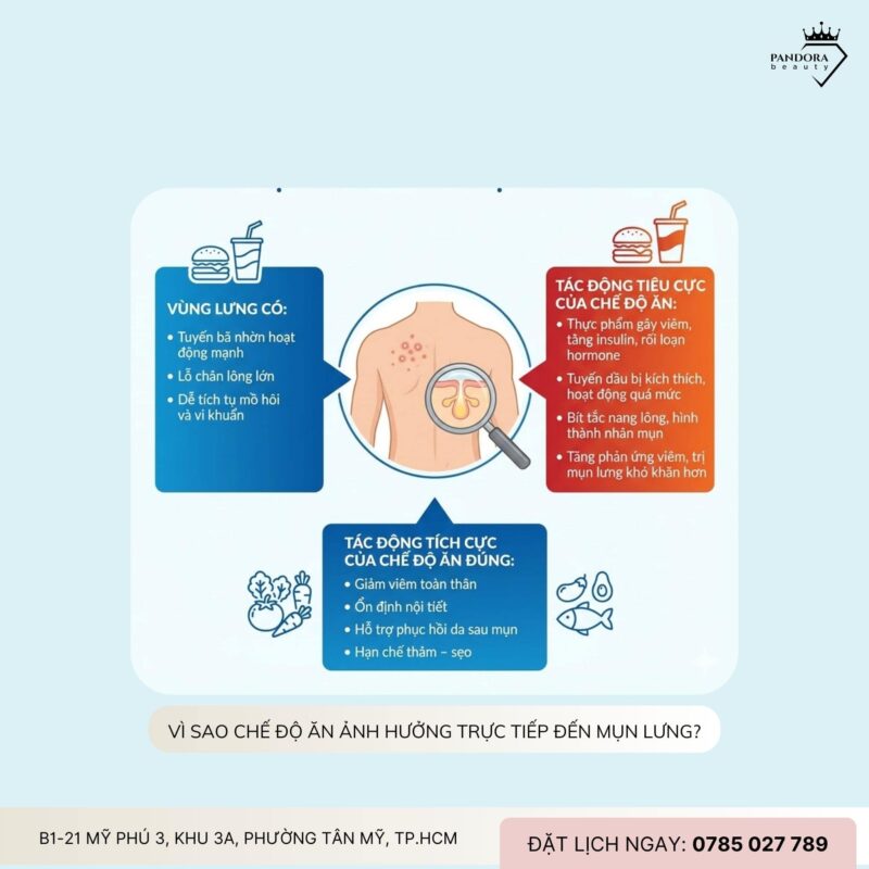 Trị mụn lưng từ bên trong: Thực phẩm nào thực sự hỗ trợ làn da sạch mụn?