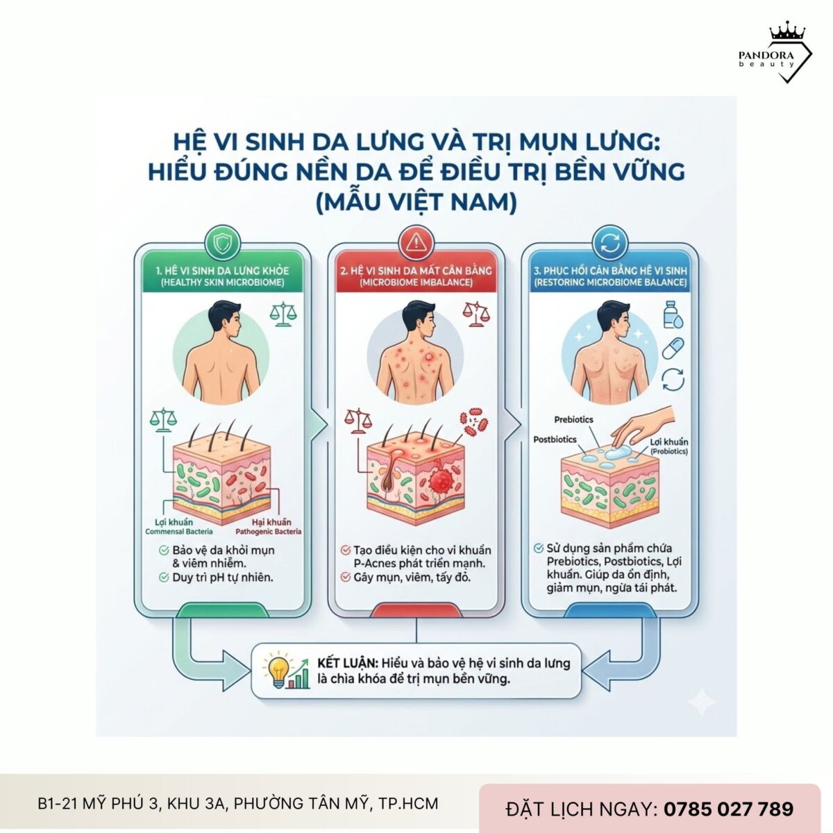 Hệ vi sinh da lưng và trị mụn lưng: Hiểu đúng nền da để điều trị bền vững