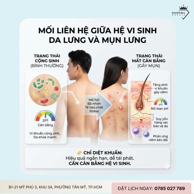 Hệ vi sinh da lưng và trị mụn lưng: Hiểu đúng nền da để điều trị bền vững