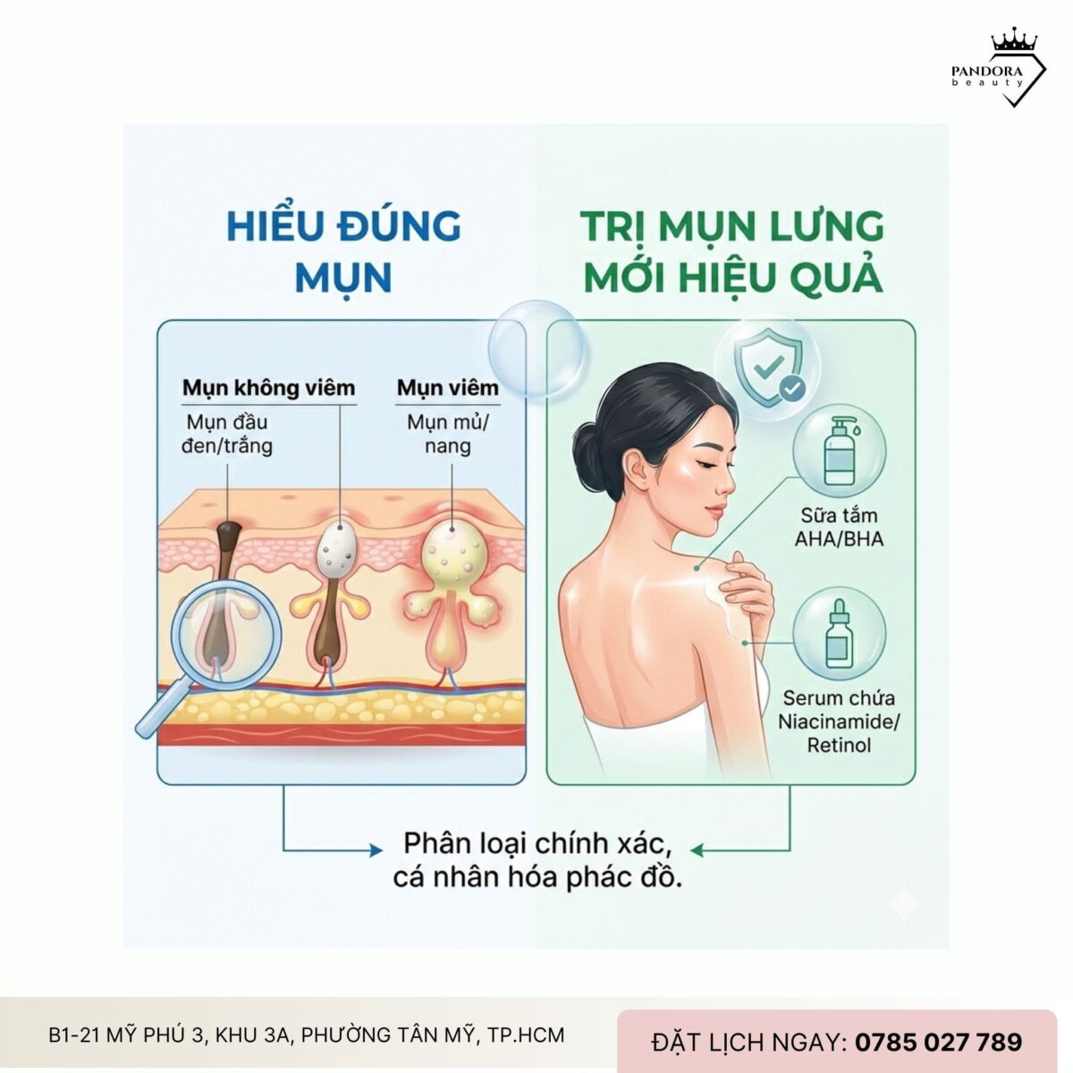 Phân biệt và điều trị mụn lưng các loại: Hiểu đúng mụn – trị mụn lưng mới hiệu quả